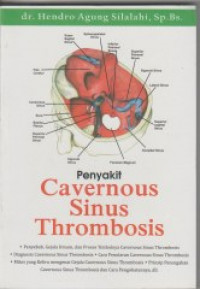 Penyakit Cavernous Sinus Thrombosis